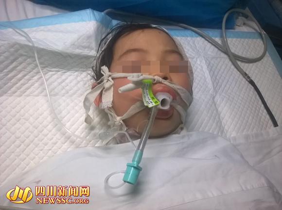 四川10岁女孩被养母砍成重伤目前已脱离生命危险