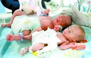 双胞胎婴儿共用胎盘 哥哥重4斤弟弟仅700克(图)